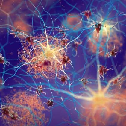 Cure Alzheimer's Fund